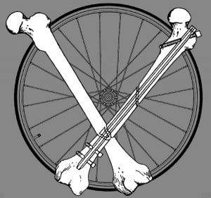 MJ.Femur.Wheel.Image